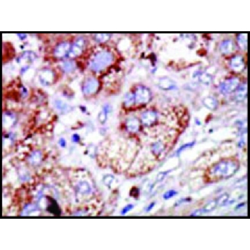 Anti-PFKFB4 (center) antibody produced in rabbit，100UG，SAB1300132-100UG，Sigma