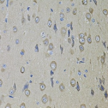 Anti-SMO antibody produced in rabbit，100UL，SAB5700794-100UL，Sigma