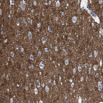 Anti-IGSF8 antibody produced in rabbit，100UL，HPA011917-100UL，Sigma