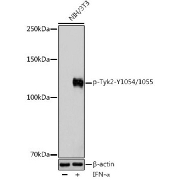Anti-Phospho-Tyk2-Y1054/1055 antibody produced in rabbit，100UL，SAB5701774-100UL，Sigma