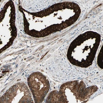 Anti-ACVR1C antibody produced in rabbit，100UL，HPA007982-100UL，Sigma