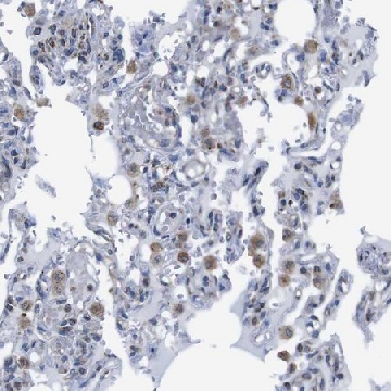 Anti-PDCD1LG2 antibody produced in rabbit，100UL，HPA013411-100UL，Sigma