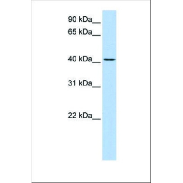 Anti-TMEM144 antibody produced in rabbit，100UL，SAB2102456-100UL，Sigma