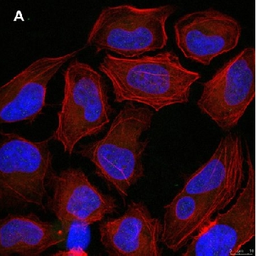 Anti-p-Ubiquitin (pSer65) Antibody, clone 2N21 ZooMAb® Rabbit Monoclonal，4X25UL，ZRB1494-4X25UL，Sigma