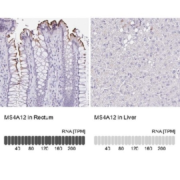 Anti-MS4A12 antibody produced in rabbit，100UL，HPA057657-100UL，Sigma