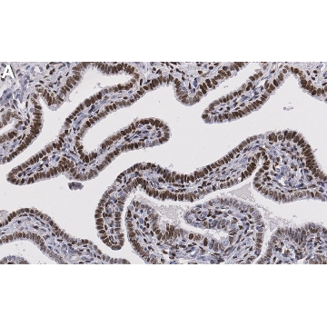 Anti-Progesterone Receptor Antibody, clone 1D2 ZooMAb® Rabbit，25UL，ZRB1845-25UL，Sigma
