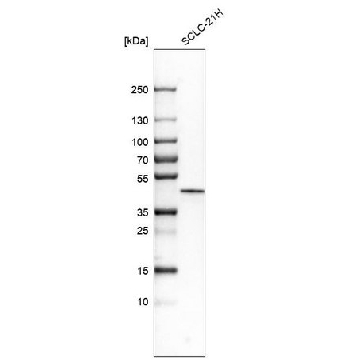 Anti-CSNK1E antibody produced in rabbit，100UL，HPA026288-100UL，Sigma