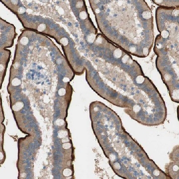 Anti-PRRG4 antibody produced in rabbit，100UL，HPA009040-100UL，Sigma