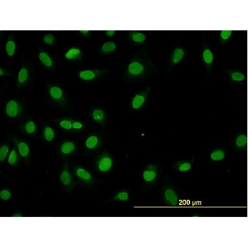 ANTI-HNF4A antibody produced in mouse，100UG，SAB1412164-100UG，Sigma
