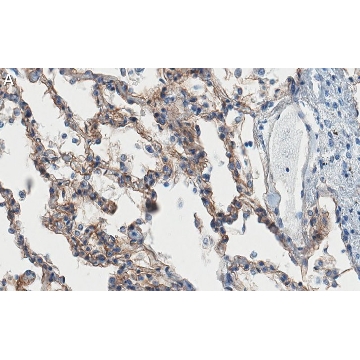Anti-ITGA3 Antibody, clone 1D6 ZooMAb® Rabbit Monoclonal，25UL，ZRB1389-25UL，Sigma