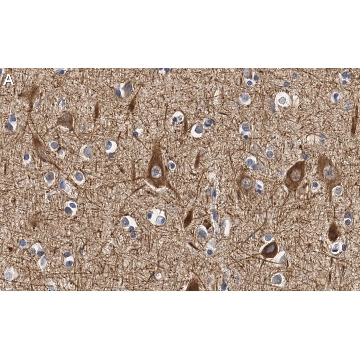 Anti-Neurofilament M Antibody, clone 1B23 ZooMAb® Rabbit Monoclonal，25UL，ZRB1411-25UL，Sigma