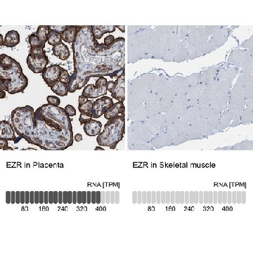 Anti-EZR antibody produced in rabbit，100UL，HPA021616-100UL，Sigma