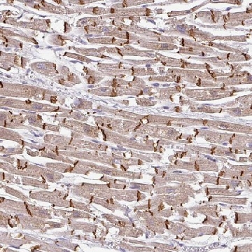 Anti-JPH2 antibody produced in rabbit，100UL，HPA052646-100UL，Sigma