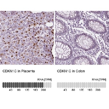 Anti-CDKN1C antibody produced in rabbit，100UL，HPA002924-100UL，Sigma
