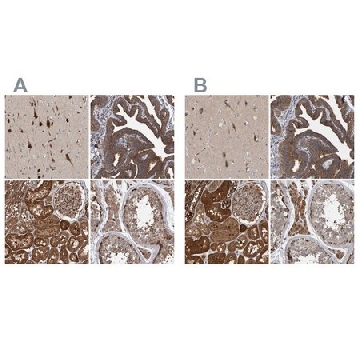 Anti-KIAA0753 antibody produced in rabbit，100UL，HPA023057-100UL，Sigma