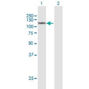 Anti-SULF1 antibody produced in rabbit，100UG，SAB1410410-100UG，Sigma