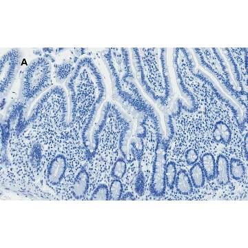 Anti-AMPK alpha Antibody, clone 2D22, ZooMAb® Rabbit Monoclonal，25UL，ZRB1100-25UL，Sigma