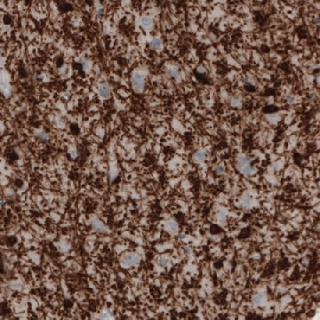 Monoclonal Anti-CNP antibody produced in mouse，100UL，AMAB91072-100UL，Sigma