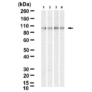Anti-IKKβ Antibody, clone 2N22 ZooMAb® Rabbit Monoclonal，4X25UL，ZRB1595-4X25UL，Sigma