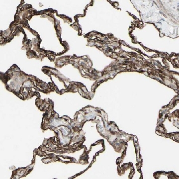 Anti-DTX3L antibody produced in rabbit，100UL，HPA010570-100UL，Sigma