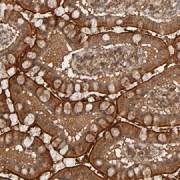 Anti-RPS6KA6 antibody produced in rabbit，100UL，HPA003904-100UL，Sigma
