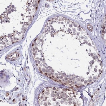 Anti-TCOF1 antibody produced in rabbit，100UL，HPA038237-100UL，Sigma