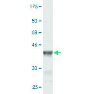 Monoclonal Anti-CHRNE antibody produced in mouse，100UG，SAB1403669-100UG，Sigma