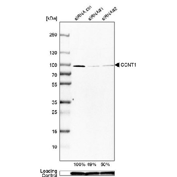 Anti-CCNT1 antibody produced in rabbit，100UL，HPA004892-100UL，Sigma