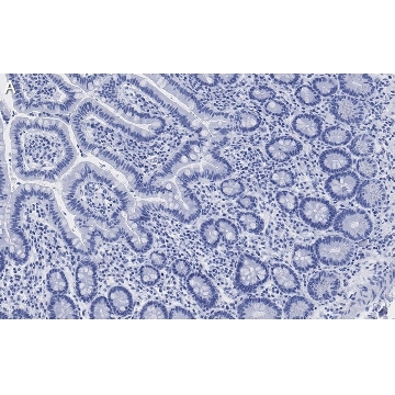 Anti-LONP1 Antibody, clone 1I18, ZooMAb® Rabbit Monoclonal，25UL，ZRB1314-25UL，Sigma