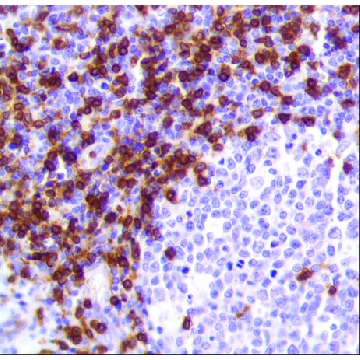 Anti-CD3 antibody, Rabbit monoclonal，100UL，SAB5500057-100UL，Sigma