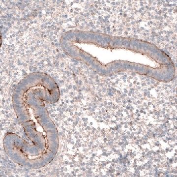 Anti-LRRC15 antibody produced in rabbit，100UL，HPA035503-100UL，Sigma