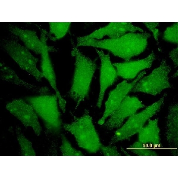 Monoclonal Anti-MGAT4B antibody produced in mouse，100UG，WH0011282M1-100UG，Sigma