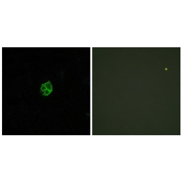 Anti-GPR151 antibody produced in rabbit，100UG，SAB4500418-100UG，Sigma