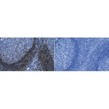 Anti-ZAP-70 Antibody, clone 1D9 ZooMAb® Rabbit Monoclonal，4X25UL，ZRB2144-4X25UL，Sigma