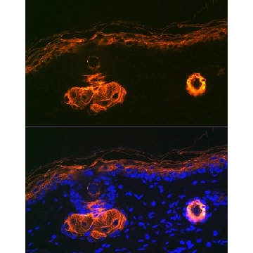 Anti-Cytokeratin 2e (KRT2) Antibody, clone 9T3Q2, Rabbit Monoclonal，100UL，SAB5702299-100UL，Sigma