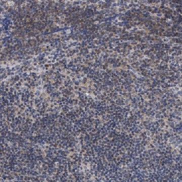 Anti-ANKRD55 antibody produced in rabbit，100UL，HPA051049-100UL，Sigma