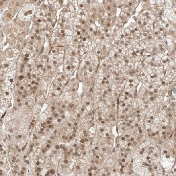 Anti-ZNF318 antibody produced in rabbit，100UL，HPA027031-100UL，Sigma