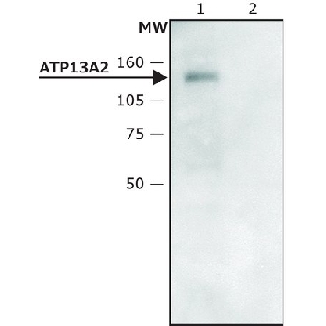 Anti-ATP13A2 (C-terminal region) antibody produced in rabbit，200UL，A3361-200UL，Sigma