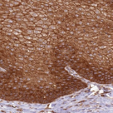 Anti-AIM1 antibody produced in rabbit，100UL，HPA030948-100UL，Sigma