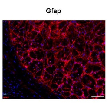 抗  GFAP 兔抗，100UL，SAB2107063-100UL，Sigma