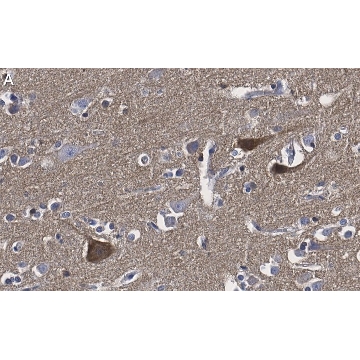 Anti-BDNF Antibody, clone 1I14 ZooMAb® Rabbit Monoclonal，4X25UL，ZRB1136-4X25UL，Sigma