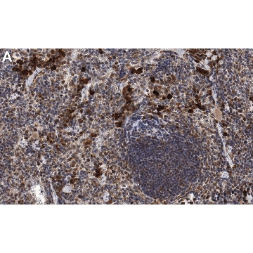 Anti-IL-6 Antibody, clone 1G18 ZooMAb® Rabbit Monoclonal，4X25UL，ZRB1970-4X25UL，Sigma