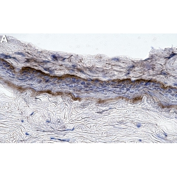 Anti-Collagen Type VII Antibody, clone NP32 ZooMAb® Mouse Monoclonal，25UL，ZMS1158-25UL，Sigma