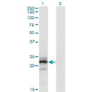 Monoclonal Anti-CGB, (C-terminal) antibody produced in mouse，100UG，SAB1402721-100UG，Sigma