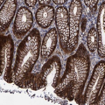 Anti-SLIT2 antibody produced in rabbit，100UL，HPA023088-100UL，Sigma