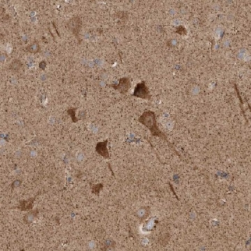 Anti-KIF21B antibody produced in rabbit，100UL，HPA027249-100UL，Sigma