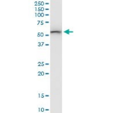 Anti-SARS2 antibody produced in mouse，50UG，SAB1400593-50UG，Sigma