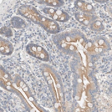 Anti-TUBD1 antibody produced in rabbit，100UL，HPA023980-100UL，Sigma