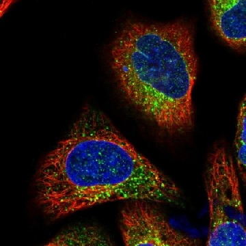Anti-TMC7 antibody produced in rabbit，100UL，HPA029465-100UL，Sigma