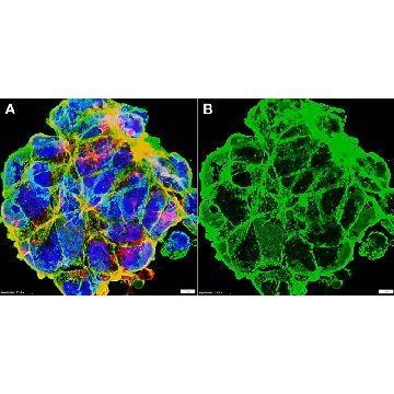 Anti-Ganglioside GD2 Antibody, clone 14G2a ZooMAb® Mouse Monoclonal，254G，ZMS1113-25UL，Sigma